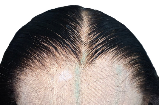 Hairline Customisation BF